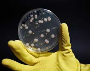 45606 На украшениях обнаружили в 400 раз больше бактерий, чем на сидении унитаза (4 фото)