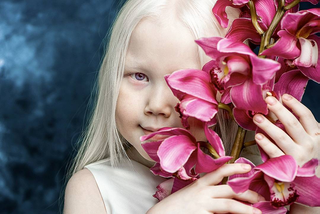 53160 Белоснежка существует: девочка-альбинос покоряет модельные агентства мира
