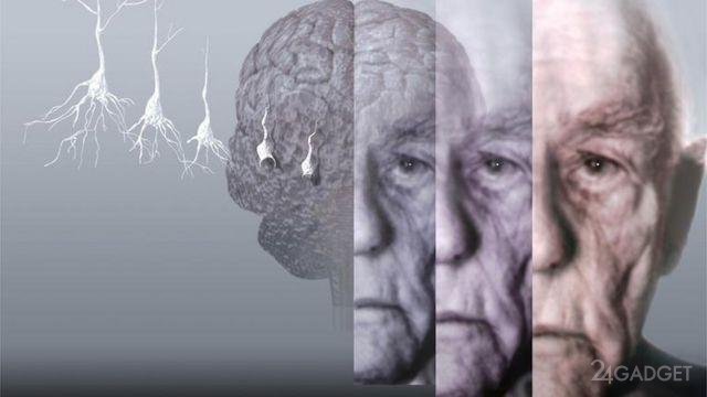 56342 Россияне приблизились к излечению болезней Альцгеймера и Паркинсона